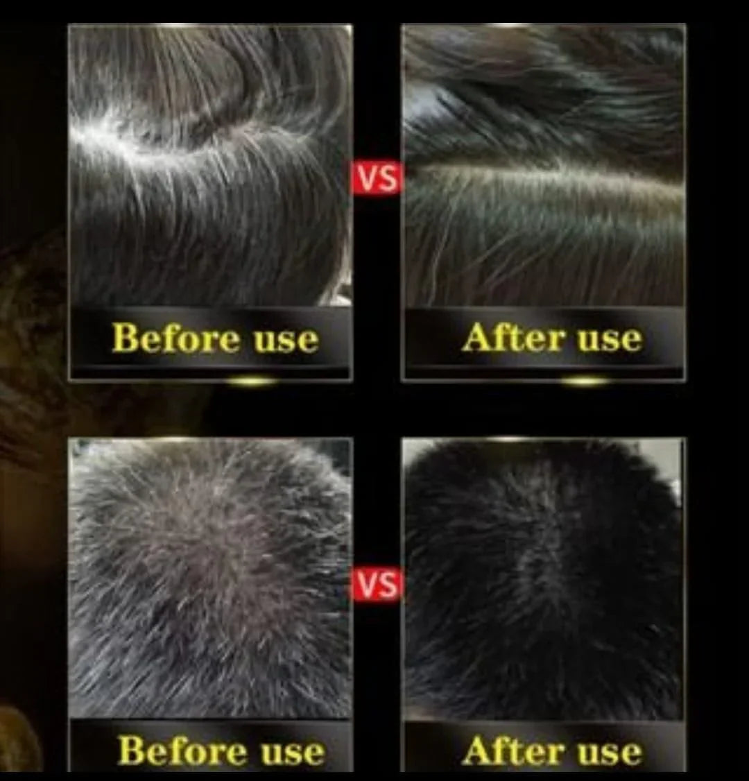 DashingDons Black Hair Shampoo 3 in 1 |  👍 Buy 1 Get 1 Free | 😍 67900+ HAPPY CUSTOMERS
