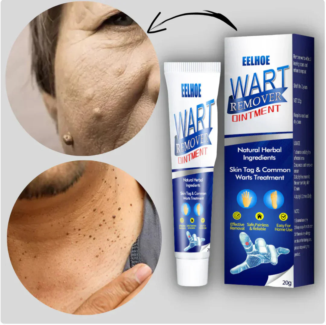 Wart Remover Instant Cream Pack of 2