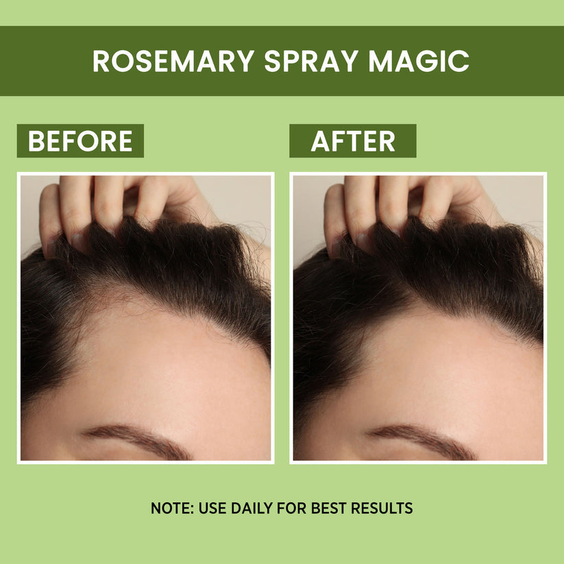 🔥BUY 1 GET 1 FREE🔥 ROSEMARY WATER, HAIR SPRAY FOR REGROWTH| 4.5⭐⭐⭐⭐⭐
